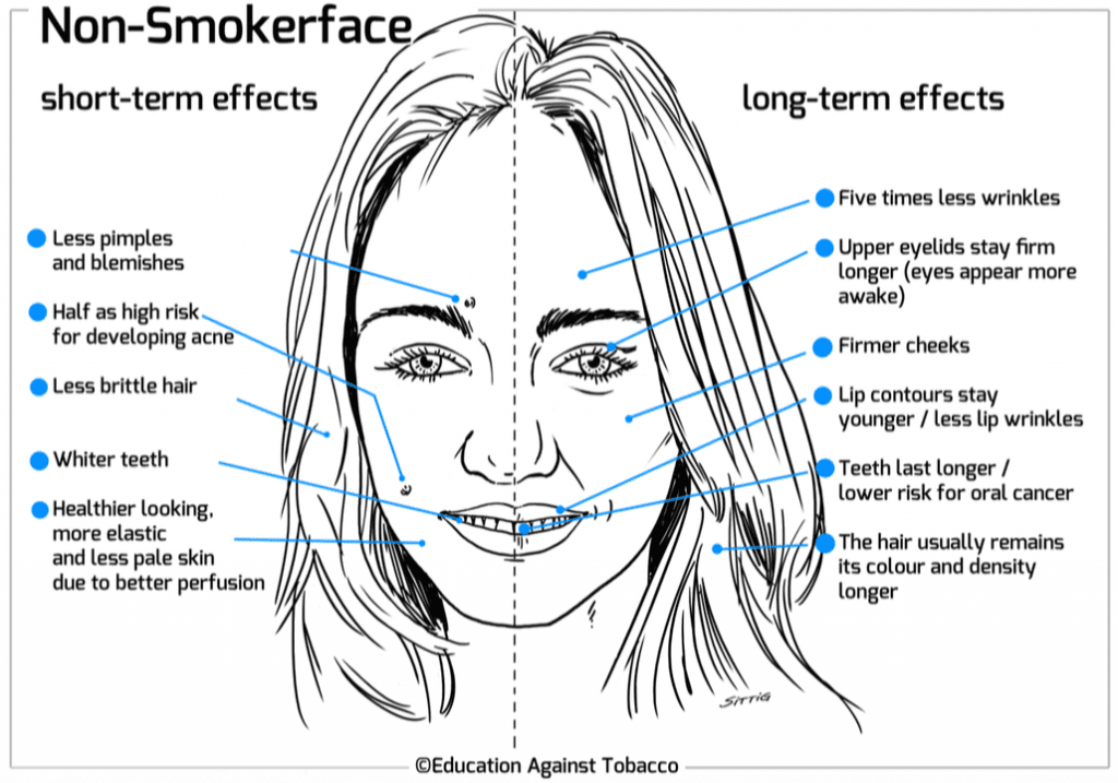 The Wrinkler – ASH > Action on Smoking & Health